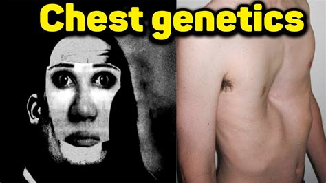 chest insertions genetics|why is my chest genetic.